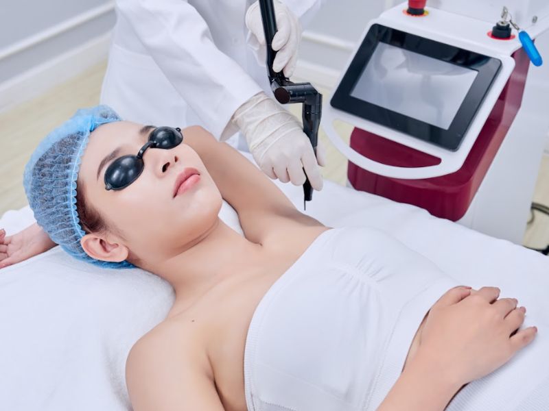 Điều trị hôi nách bằng laser - 5