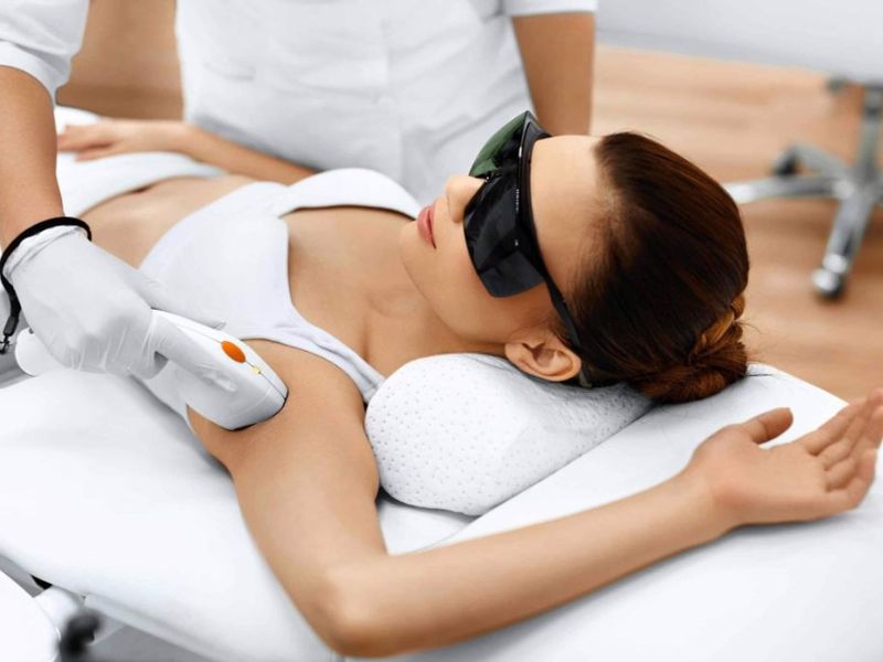 Điều trị hôi nách bằng laser - 8