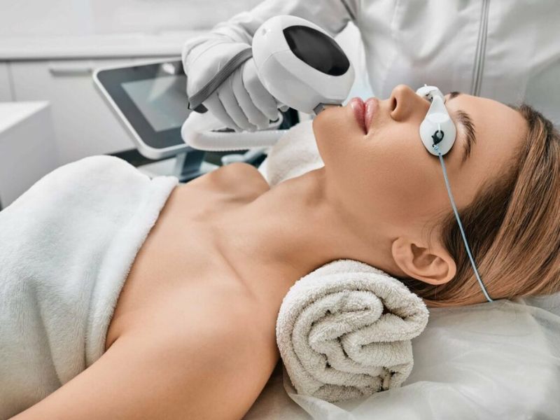 Điều trị sẹo bằng công nghệ IPL - 3