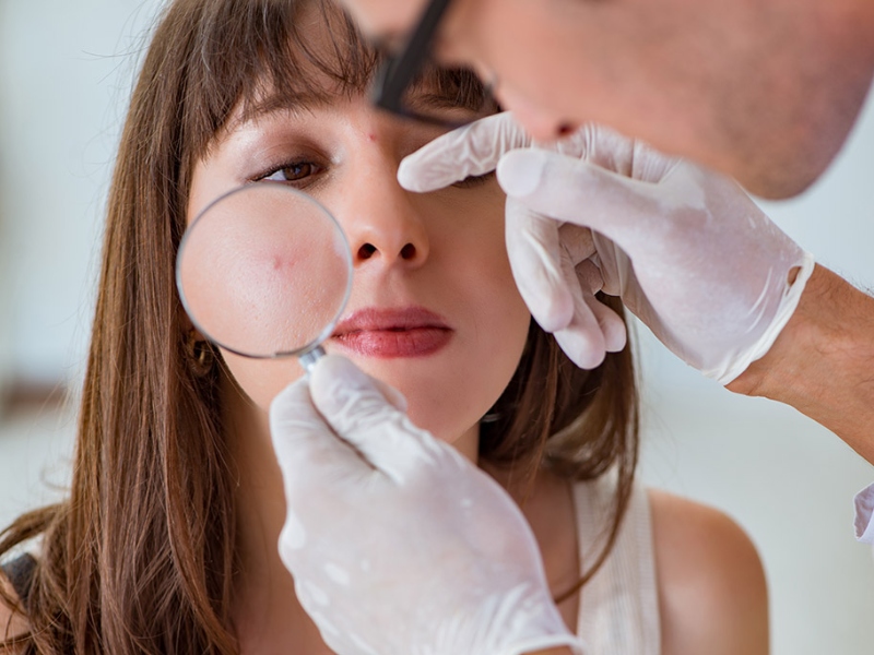 Điều trị trứng cá bằng ipl là gì - 6