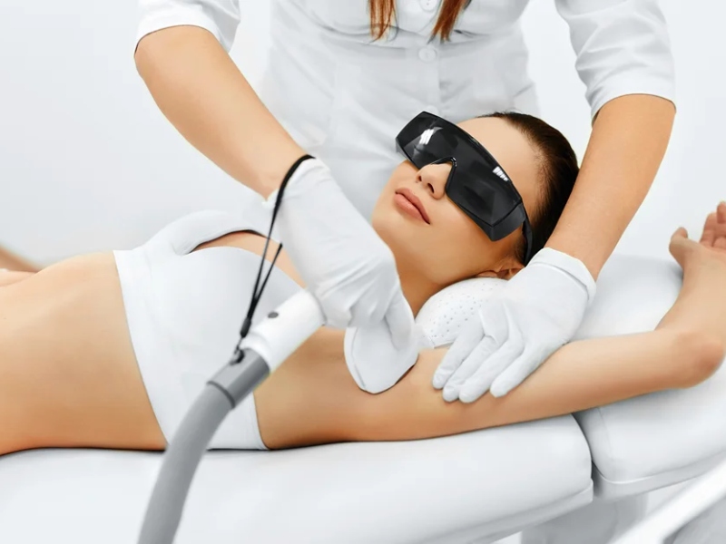 Đốt laser tuyến mồ hôi nách - 6
