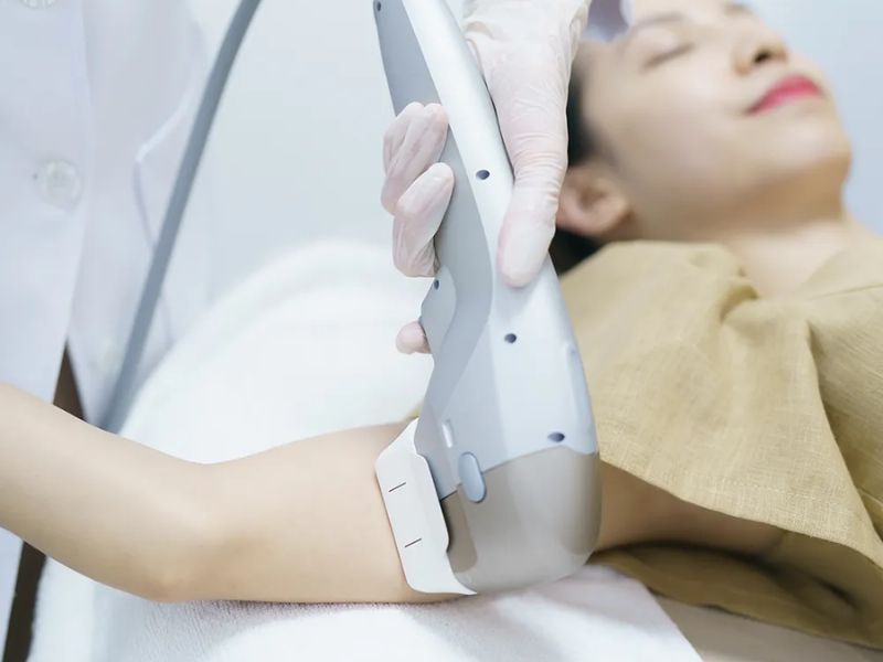 Giảm béo công nghệ HIFU - 5