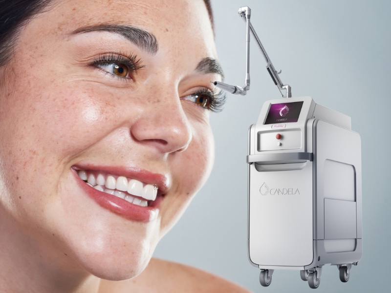 laser toning và laser picosure - 1