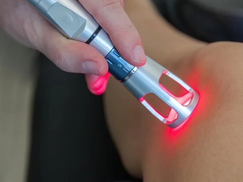 Laser trị thâm - 1