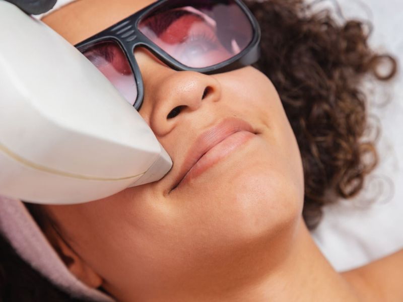 Máy triệt lông công nghệ IPL - 10