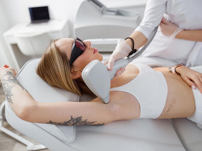 Máy triệt lông công nghệ IPL - 9