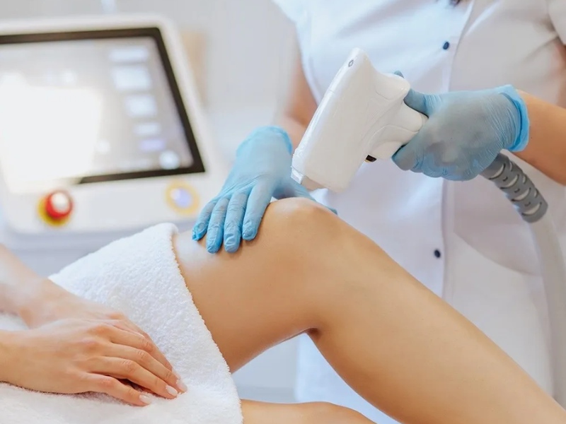 Máy triệt lông laser - 6