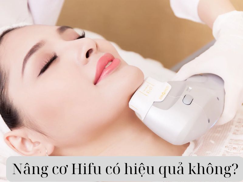 Nâng cơ Hifu có hiệu quả không - 1
