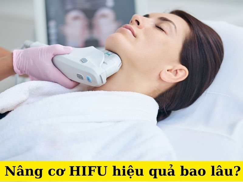 Nâng cơ HIFU hiệu quả bao lâu - 1