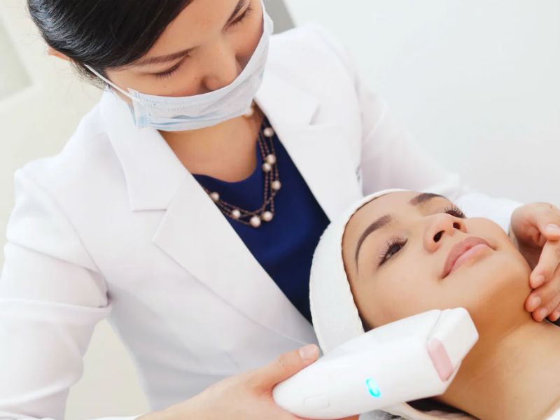 Nâng cơ HIFU hiệu quả bao lâu - 2