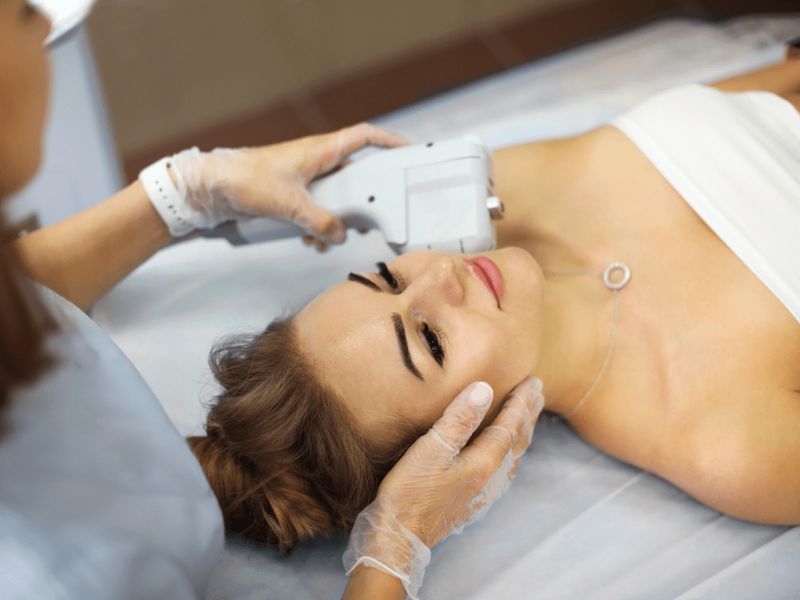 Nâng cơ HIFU hiệu quả bao lâu - 3