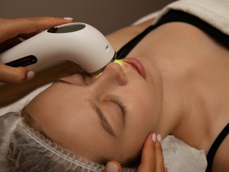 Se khít lỗ chân lông bằng tia laser - 6