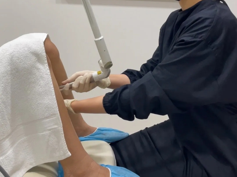se khít vùng kín bằng laser có hiệu quả không - 1