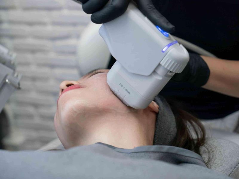 So sánh công nghệ Hifu và Thermage - 3