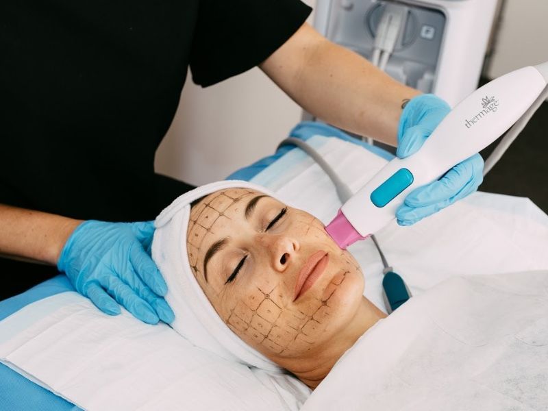 So sánh công nghệ Hifu và Thermage - 4