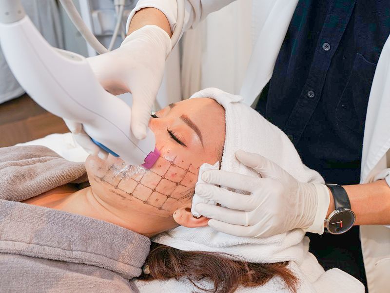 So sánh công nghệ Hifu và Thermage - 5