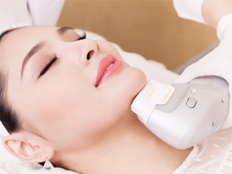 So sánh công nghệ Hifu và Thermage - 8