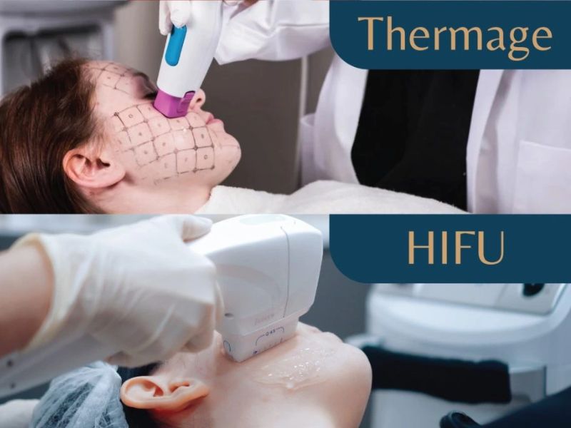 So sánh công nghệ Hifu và Thermage - 1