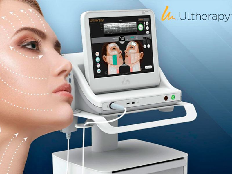 So sánh công nghệ Hifu và Ultherapy - 3