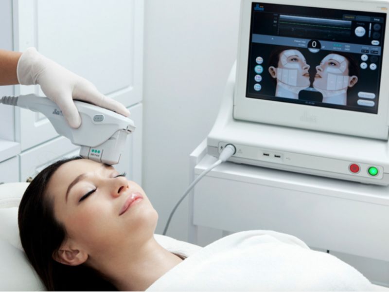 So sánh công nghệ Hifu và Ultherapy - 6