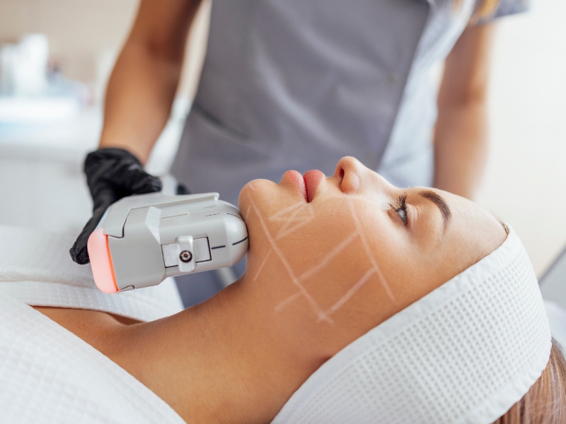 Tác hại của nâng cơ hifu - 1