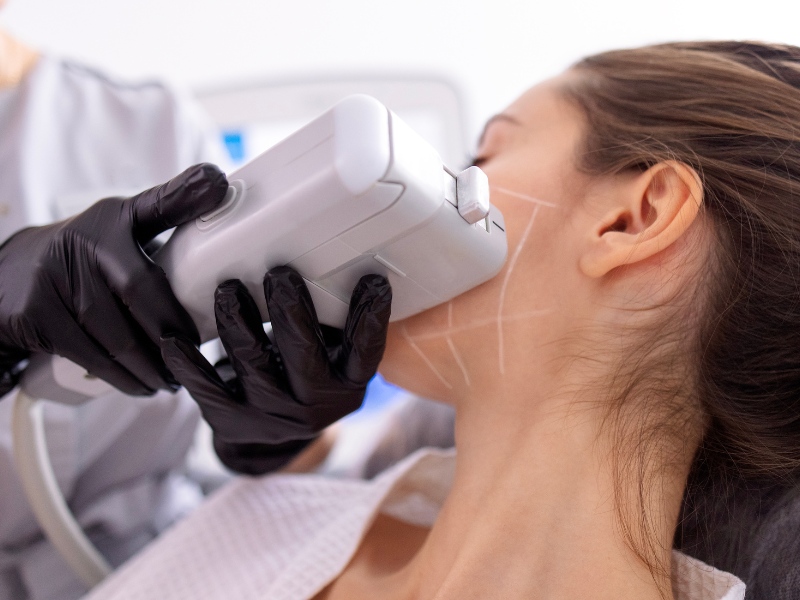 Tác hại của nâng cơ hifu - 4