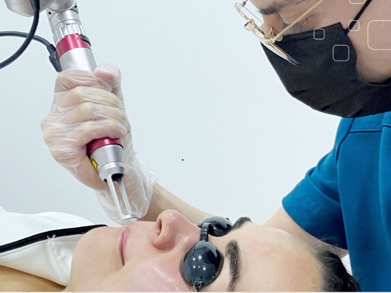 Tẩy nốt ruồi bằng laser có mọc lại không - 4