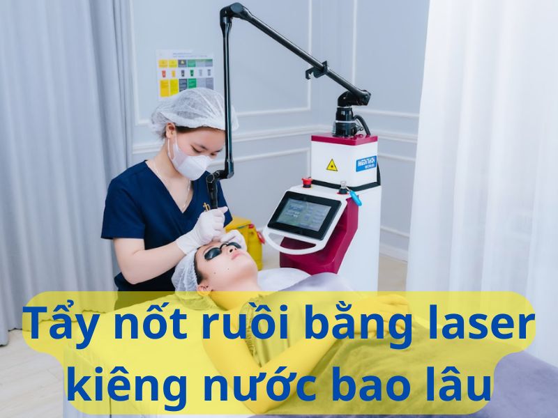 Tẩy nốt ruồi bằng laser kiêng nước bao lâu - 1