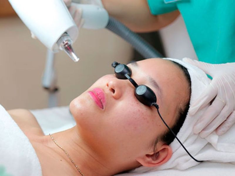 Tẩy nốt ruồi bằng tia laser bao nhiêu tiền - 6