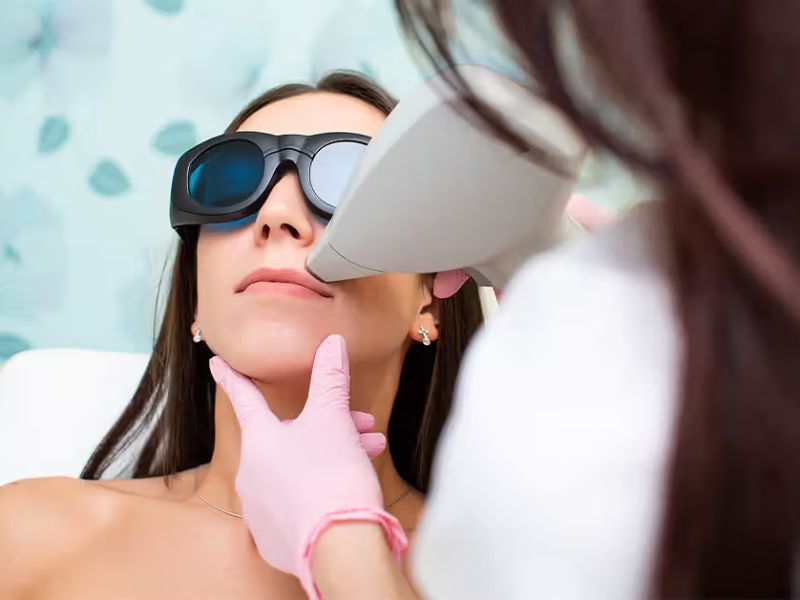 Trẻ hóa da bằng công nghệ IPL - 11