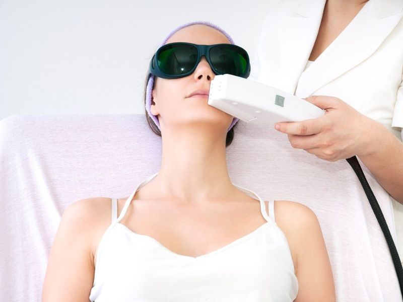 Trẻ hóa da bằng công nghệ IPL - 13