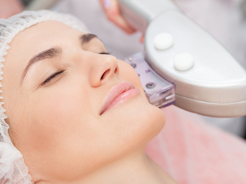 Trẻ hóa da bằng công nghệ IPL - 4