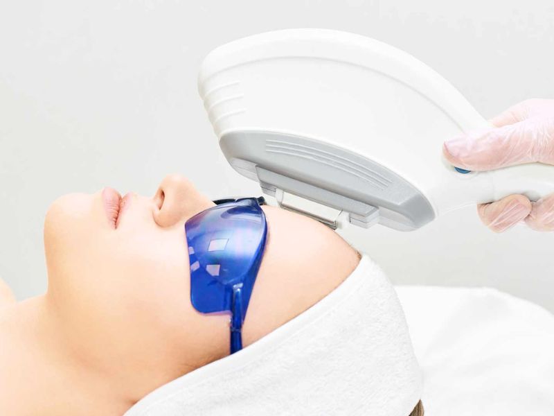 Trẻ hóa da bằng công nghệ IPL - 5