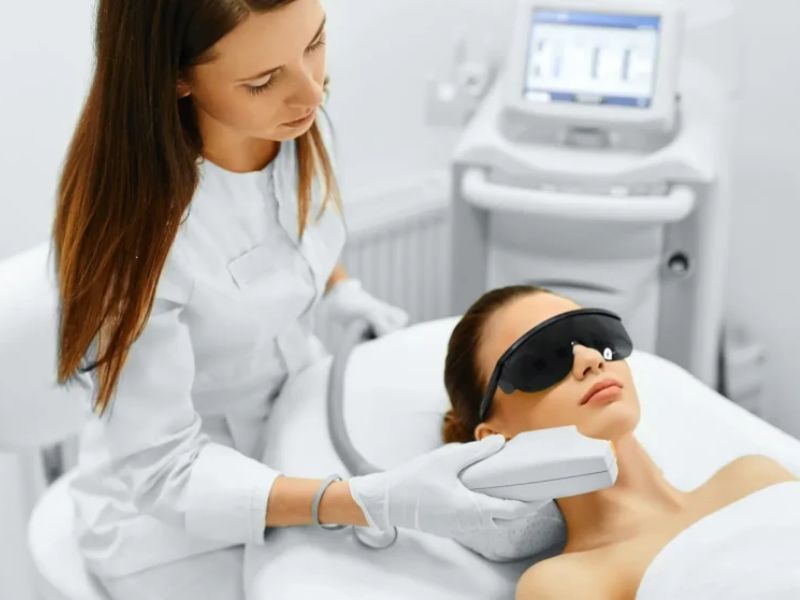 Trẻ hóa da bằng công nghệ IPL - 7