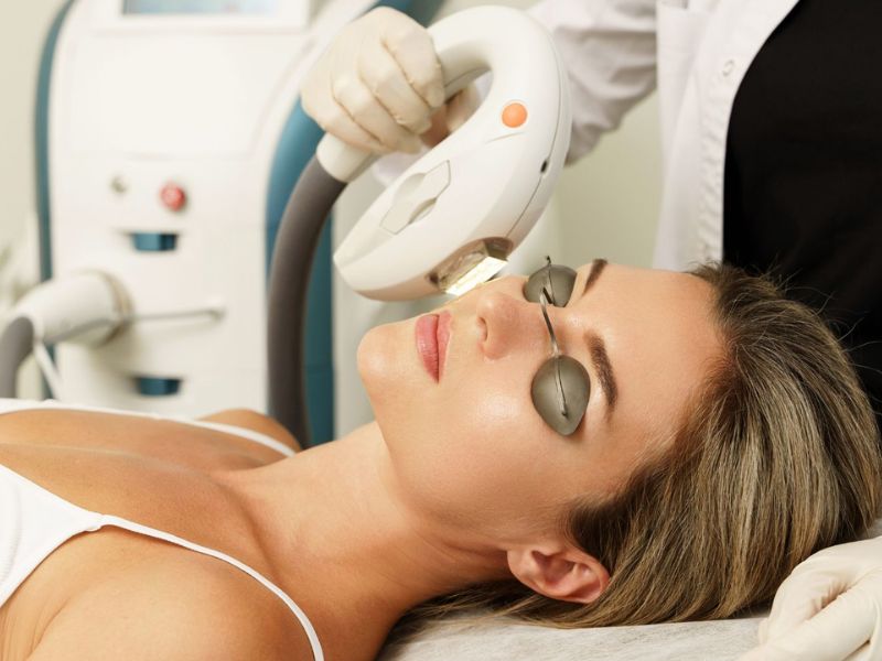 Trẻ hóa da bằng công nghệ IPL - 7