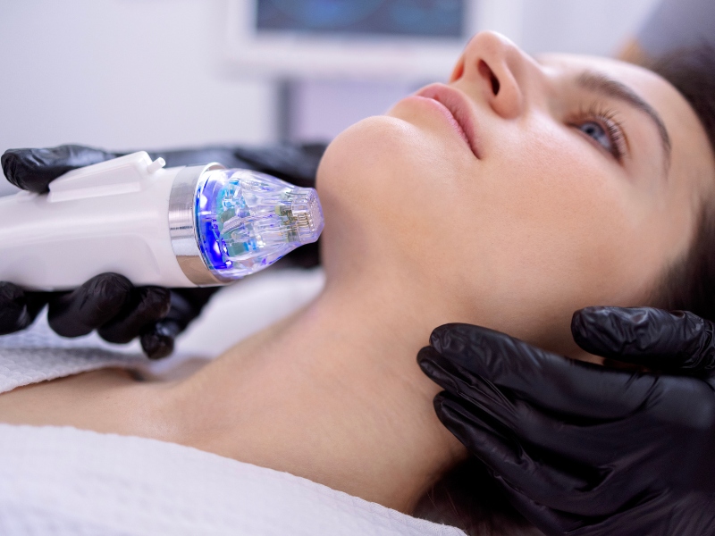 Trẻ hóa da bằng laser có tốt không - 2