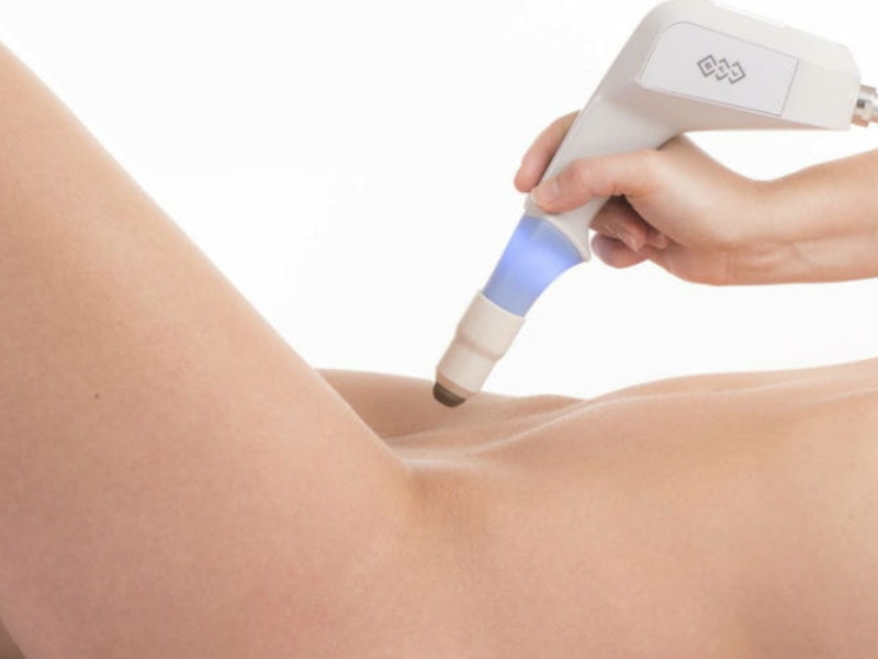 trẻ hóa vùng kín bằng laser - 3