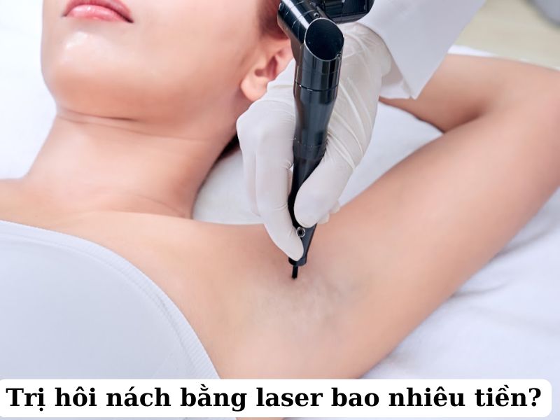 Trị hôi nách bằng laser bao nhiêu tiền -1