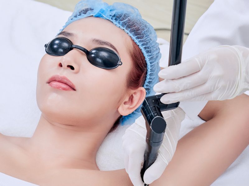 Trị hôi nách bằng laser bao nhiêu tiền - 3