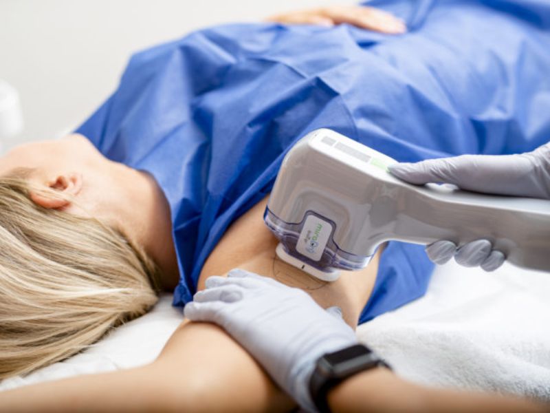 Trị hôi nách bằng laser bao nhiêu tiền - 5