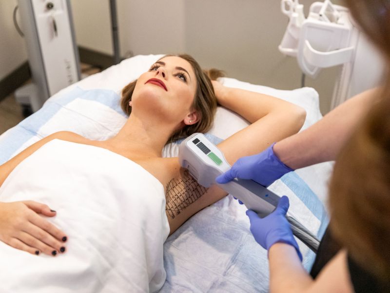 Trị hôi nách bằng laser bao nhiêu tiền - 7