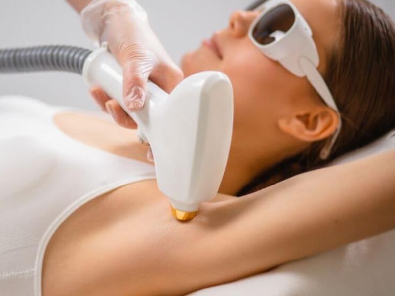 trị hôi nách bằng tia laser có hiệu quả không - 6