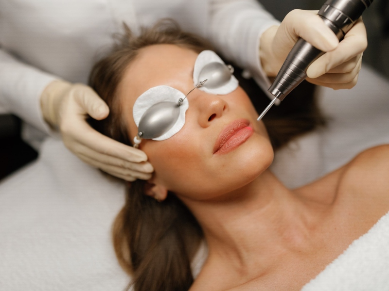 Trị môi thâm bằng laser có hiệu quả không - 3