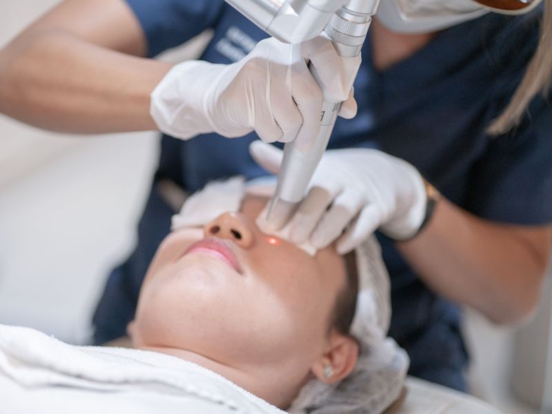 Trị mụn thịt bằng laser bao nhiêu tiền - 2