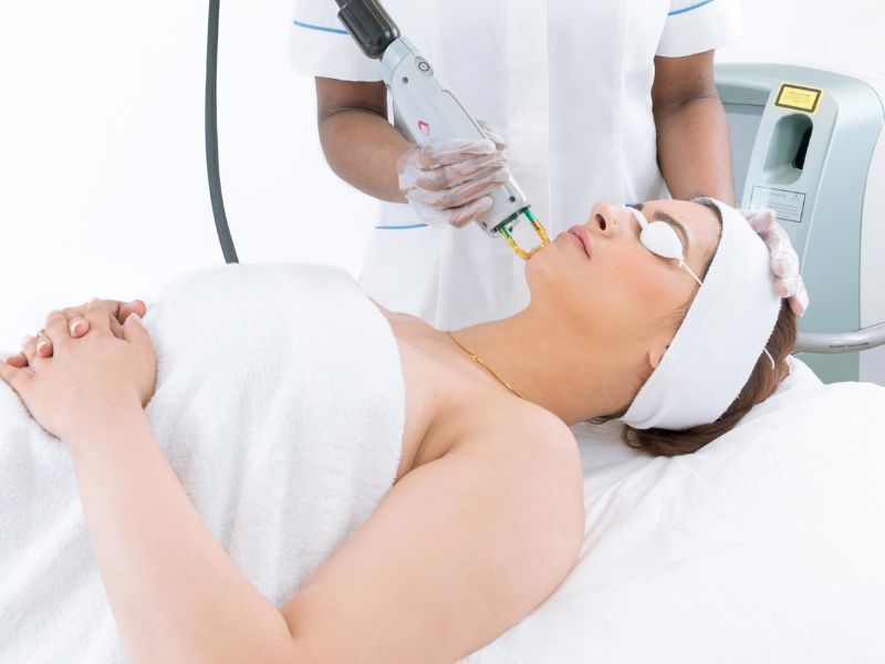 Trị mụn thịt bằng laser bao nhiêu tiền - 3
