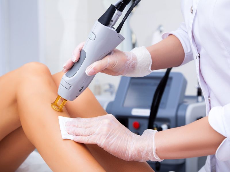 Trị mụn thịt bằng laser bao nhiêu tiền - 4