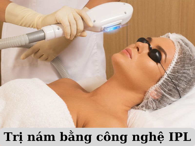 Trị nám bằng công nghệ IPL - 1
