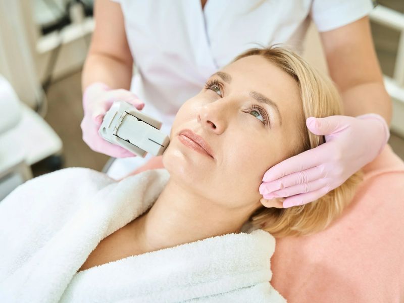 Trị nám bằng công nghệ IPL - 6