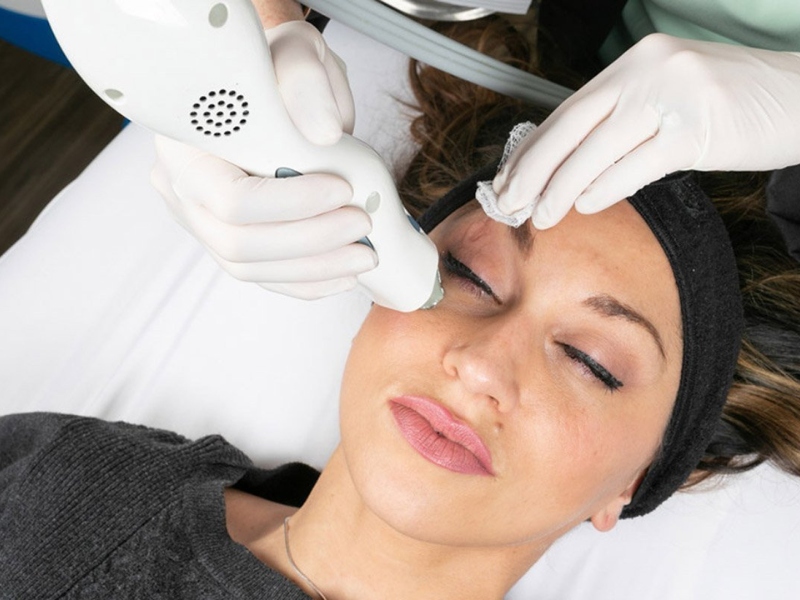 Trị thâm quầng mắt bằng laser có tốt không - 2