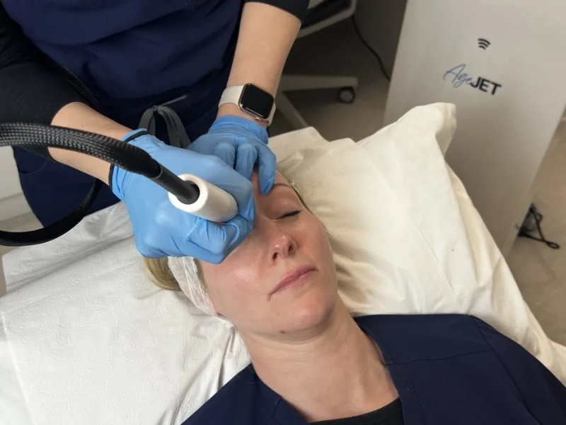 Trị thâm quầng mắt bằng laser có tốt không - 4